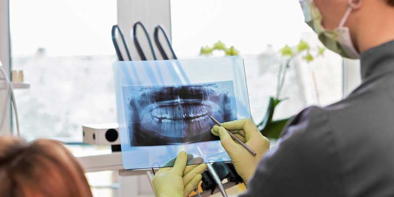 Dental X-ray