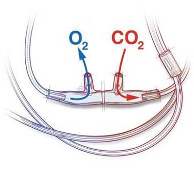 nasal cannula