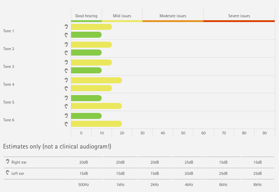 Our Phonak online hearing test results.
