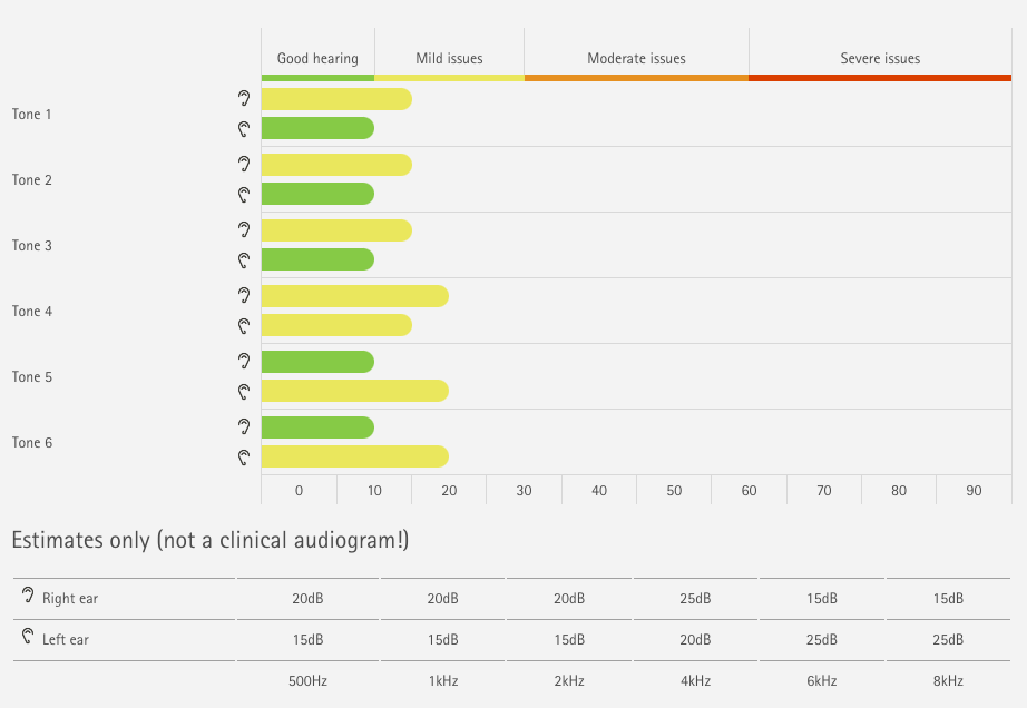 Our Phonak online hearing test results. 